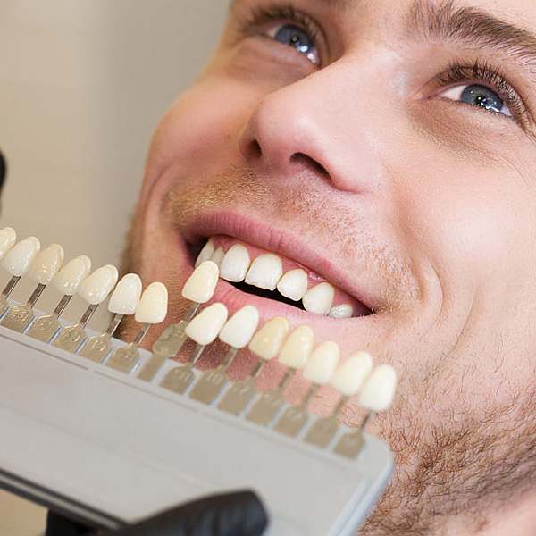 Tratamientos de Estética Dental (I)